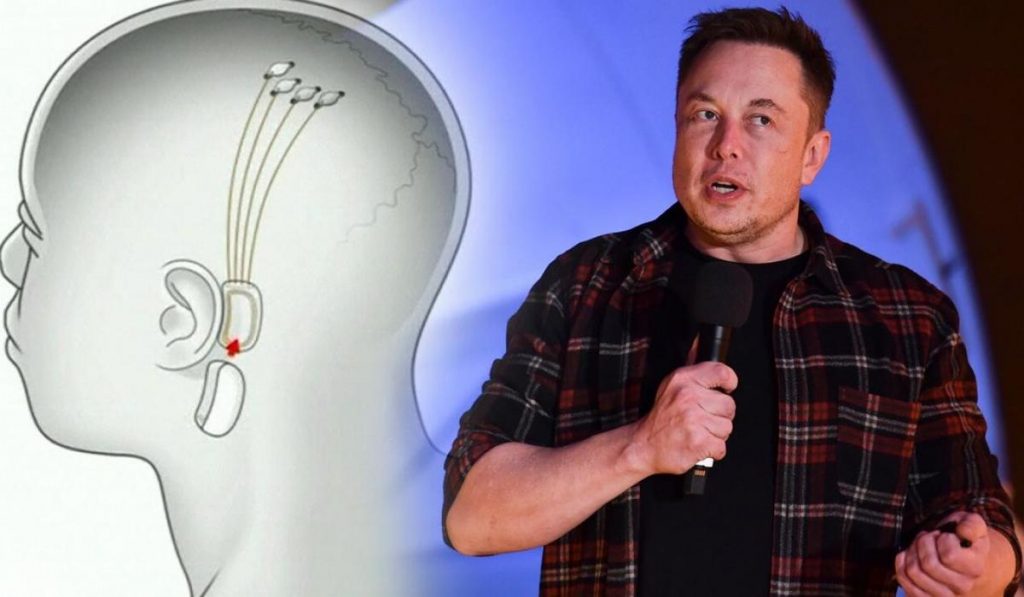 Elon Musk quer linkar seu cérebro ao seu smartphone. Aqui está o que pode acontecer.